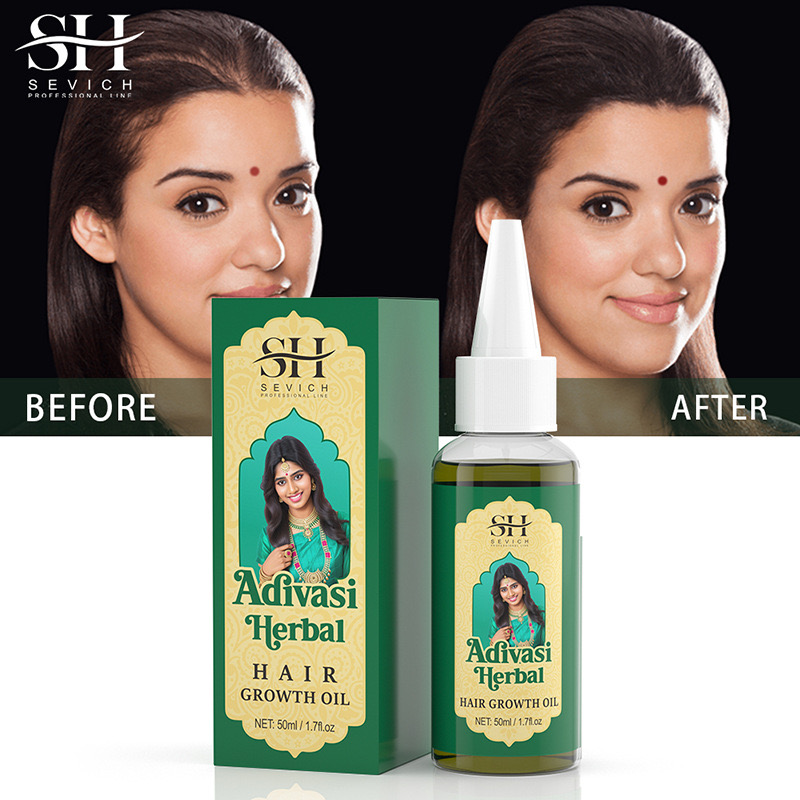 Ayurvedic & Herbal Wellness Kits - 50Ml Originele India Olie Adivasi Kruidenhaarolie