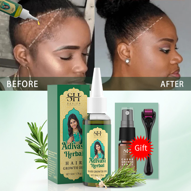 Ayurvedische haargroeiolie Ind - Ayurvedic & Herbal Wellness Kits recensie en prijs