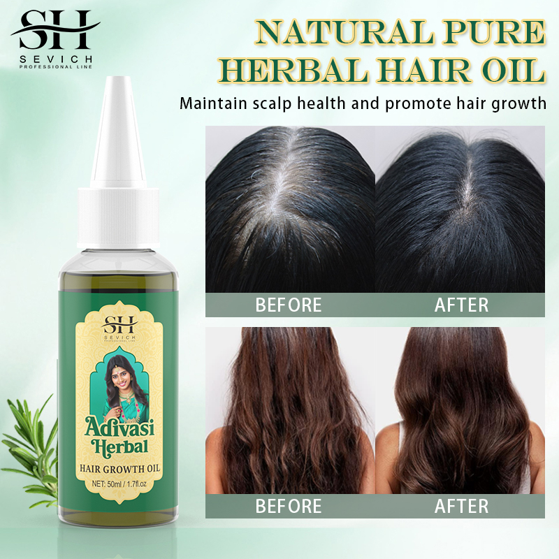 Ayurvedische Haargroei Olie Ad - Ayurvedic & Herbal Wellness Kits recensie en prijs